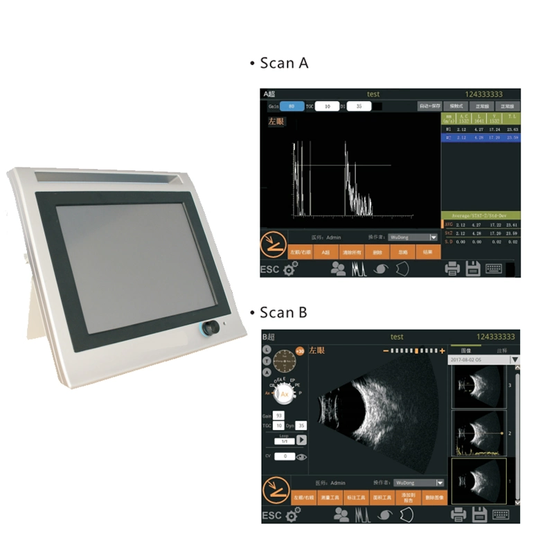 Ophthalmic Ultrasound B Scan Ultrasonic a/B Scanner for Ophthalmology