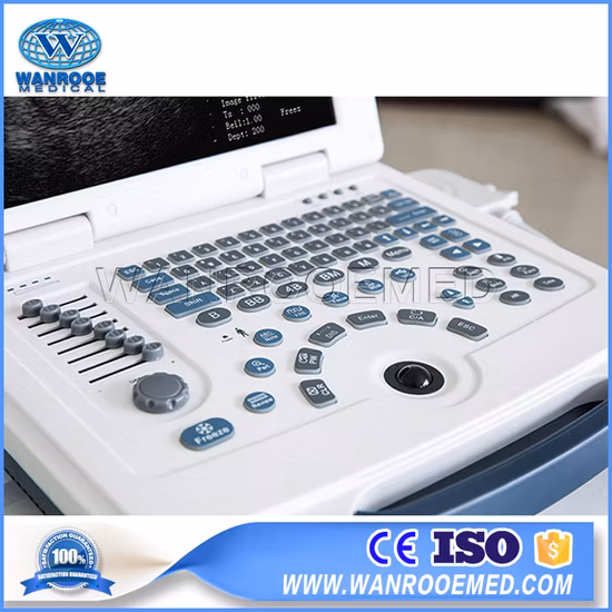 디지털 방식으로 휴대용 초음파 진단 장비 초음파 스캐너