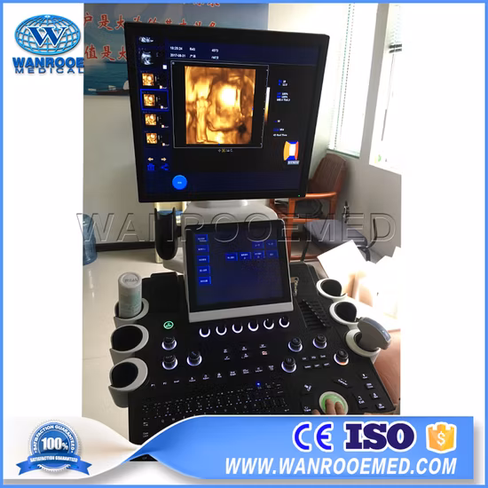 Usc900 의료 트롤리 4D 초음파 진단 시스템 컬러 도플러 초음파 스캐너